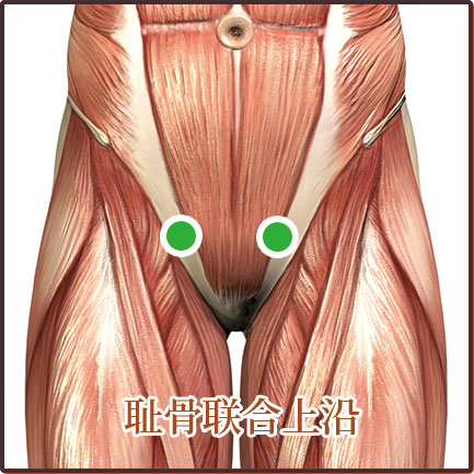 盆腔炎、尿道炎、宮頸炎、陰道炎等婦科疾病貼敷位置示意圖
